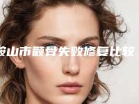 鞍山市颧骨失败修复比较好的医院(鞍山崔芳医疗美容外科诊所价格不贵口碑好)