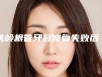 铁岭根管牙冠修复失败后遗症「铁岭根管牙冠有什么后遗症出现吗」