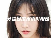 铜仁牙齿固定术术价格是多少费用