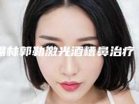 锡林郭勒激光酒糟鼻治疗的禁忌人群都有哪些呢