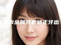 锦州市金属牙套矫正牙齿医院上榜名单前10强榜最新名单(锦州市金属牙套矫正牙齿口腔医院品牌连锁真实水平待你参考)