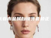 长春市金属自锁牙套矫正医生排行前10名清单列总-长春市高仙杰口腔医生