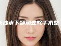 长沙市下颌角去除手术整形医院上榜名单十家公立-私立任你挑选(长沙三十二相医疗美容诊所明白人说价格实惠)