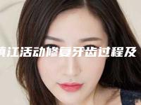 镇江活动修复牙齿过程及风险规避