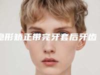隐形矫正带完牙套后牙齿痛是什么原因隐形矫正龅牙效果如何