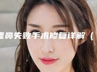 隆鼻失败手术修复详解(隆鼻失败手术修复详解视频)
