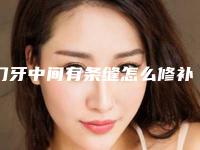 门牙中间有条缝怎么修补好(门牙中间有条缝怎么修补图片)