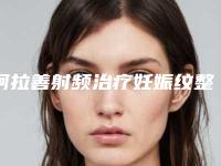 阿拉善射频治疗妊娠纹整形医生口碑好实力强-2025年阿拉善射频治疗妊娠纹口碑好的整形医生是哪几家