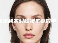 阳泉脸不对称矫正整形手术的效果怎么样价格是多少