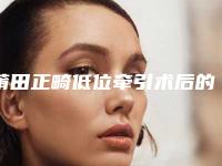 莆田正畸低位牵引术后的一般能保持几年