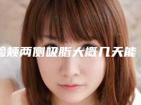 脸颊两侧吸脂大概几天能消肿