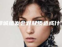 聊城植发会对肤质造成什么影响吗