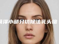菏泽小部分切除法乳头缩小术不适合的人群有哪些