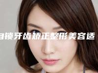 自锁牙齿矫正整形美容适合什么年纪人群