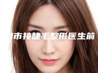 营口市接睫毛整形医生前十点评-营口市刘颖整形医生