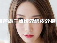 葫芦岛三点切双眼皮效果及价格怎样