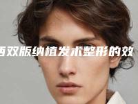 西双版纳植发术整形的效果究竟好