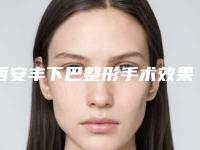 西安丰下巴整形手术效果好吗多少钱-西安丰下巴整形术都怎么收费