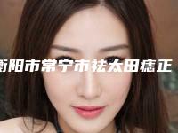 衡阳市常宁市祛太田痣正规的医院前十实力口碑双双在线,常宁市祛太田痣技术大咖医院