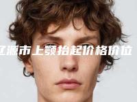 辽源市上颚抬起价格价位表热门项目爆出-辽源市上颚抬起大概需要价格是多少钱