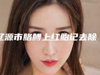 辽源市胳膊上红胎记去除价格(费用)清单总览(近6个月均价为:2478元)
