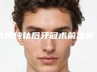 达州纯钛后牙冠术前准备和术后护理方式