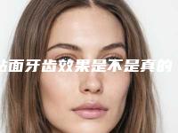 贴面牙齿效果是不是真的很好_贴面牙齿多久会有明显效果