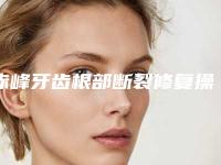 赤峰牙齿根部断裂修复操作不当会出现什么害处