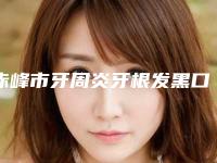 赤峰市牙周炎牙根发黑口腔医生排名榜top10强崭新出炉-赤峰市牙周炎牙根发黑医生收费不贵哦