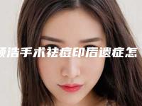 顾浩手术祛痘印后遗症怎么进行治疗