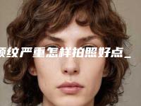 颈纹严重怎样拍照好点_激光去颈纹要做几次