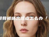 颧骨被晒出斑点怎么办「磨颧骨手术适合什么样的人呢」