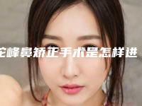 驼峰鼻矫正手术是怎样进行的(驼峰鼻手术怎么做)