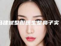 马建斌整形医生整鼻子实力表现亮眼-南开大学附属医院整形外科