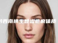 黔西南横生智齿疤痕体质的人可不可以做