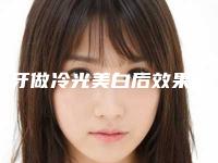 黄牙做冷光美白后效果能保持多久