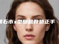 黄石市x型腿截骨矫正手术医院上榜清单前十强哪个实力强(黄石德尔美客美亚整形美容名单实力现场一一公布)