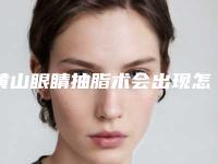 黄山眼睛抽脂术会出现怎样的副作用