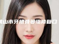 黄山市牙槽骨萎缩修复口腔医生排行名单合集-黄山市牙槽骨萎缩修复医生2025美容价格表在线查询