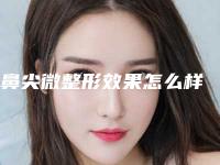 鼻尖微整形效果怎么样