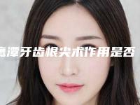 鹰潭牙齿根尖术作用是否持久