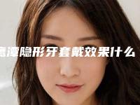 鹰潭隐形牙套戴效果什么时候才能出来