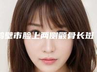 鹤壁市脸上两侧颧骨长斑医生排名榜公立私立pk详情-刘建国整形医生正规又靠谱_值得信赖
