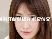 鹤岗牙龈壁提升术又快又安全_鹤岗牙龈壁提升术术如何避免安全隐患