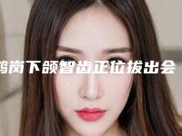 鹤岗下颌智齿正位拔出会不会有害于人体
